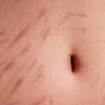 Depressive Tochter: "Papi, ich habe schon überlegt, mich zu ritzen"