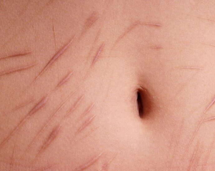 Depressive Tochter: "Papi, ich habe schon überlegt, mich zu ritzen"