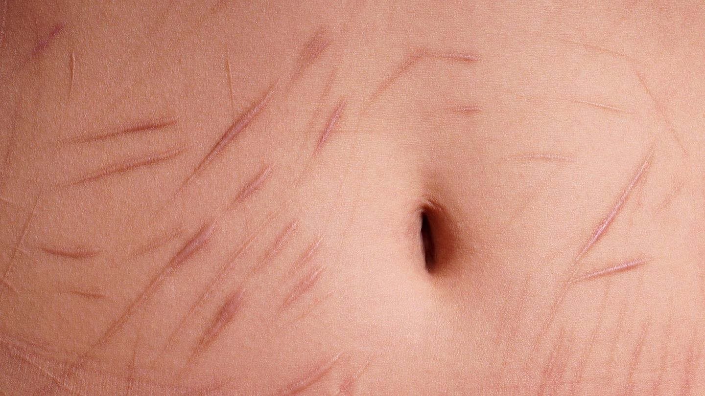 Depressive Tochter: "Papi, ich habe schon überlegt, mich zu ritzen"