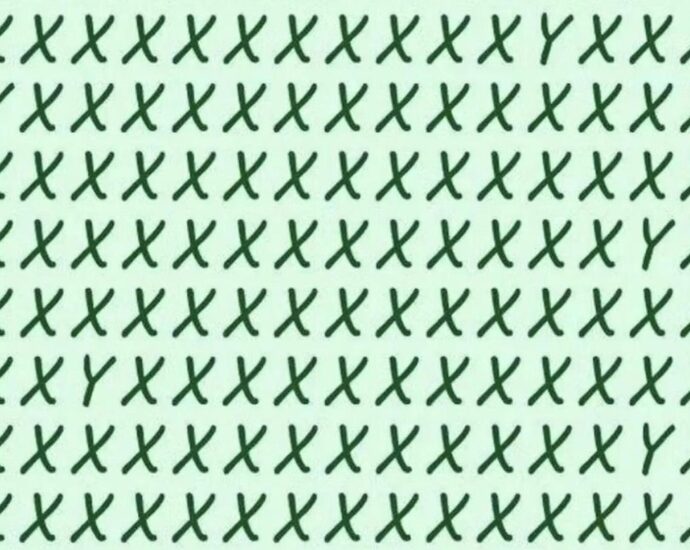 Teste deinen Fokus: Findest du hier alle Buchstaben, die kein „X“ sind?