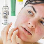 Rötungen und Unreinheiten: 12 effektive Produkte mit Zink gegen Rötungen
