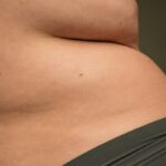 Bauch in den Wechseljahren: Geht der auch wieder weg?