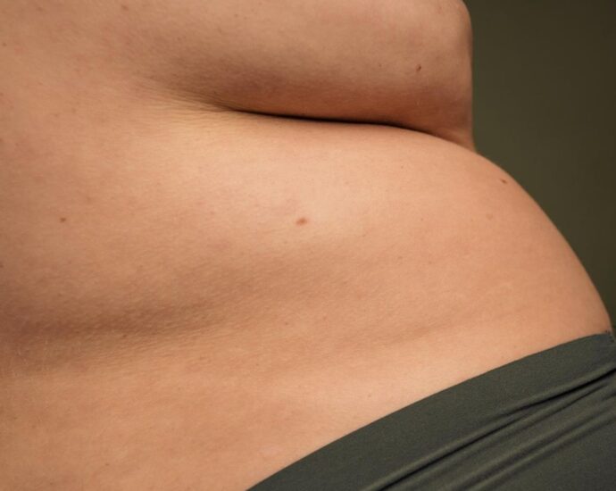 Bauch in den Wechseljahren: Geht der auch wieder weg?