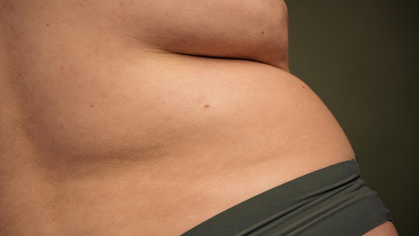 Bauch in den Wechseljahren: Geht der auch wieder weg?