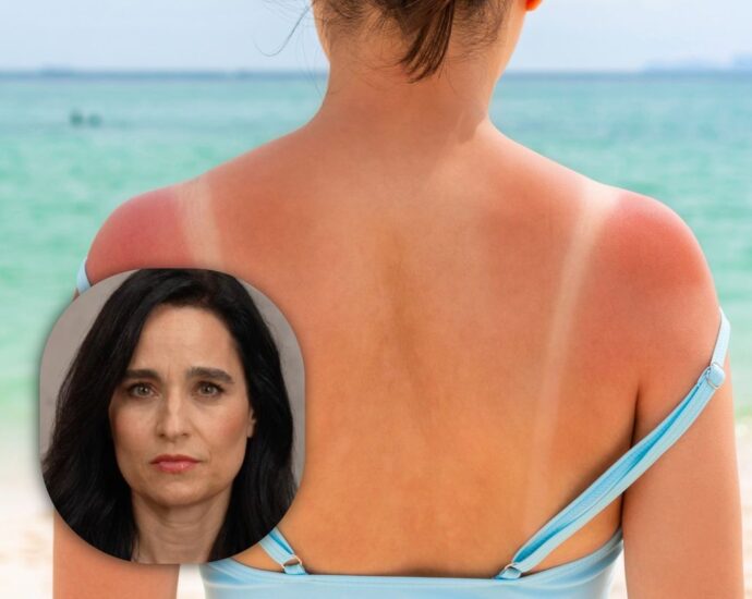 Unterschätztes Hautkrebs-Risiko: Dr. Yael Adler: "Viele wiegen sich durch Sonnencreme in falscher Sicherheit"
